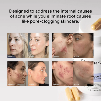 MineraNatural Glow & Go™ – Dietary Supplement for Calming Breakouts and Reducing Acne (90 Capsules)